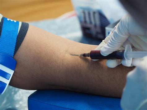 vein hard after blood test|bleeding veins on skin.